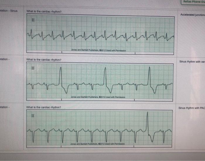 Relias medical surgical-telemetry rn b answers