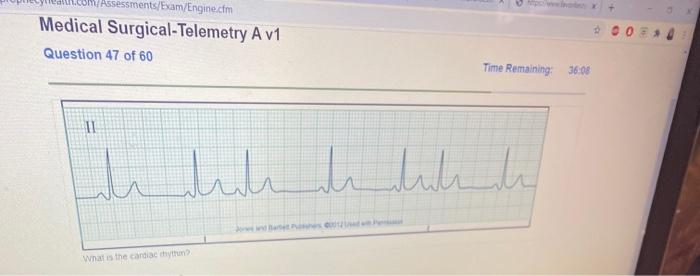 Relias medical surgical-telemetry rn b answers